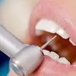 Zahnbehandlung und Prothetik im Sanatorium Kvitka poloniny